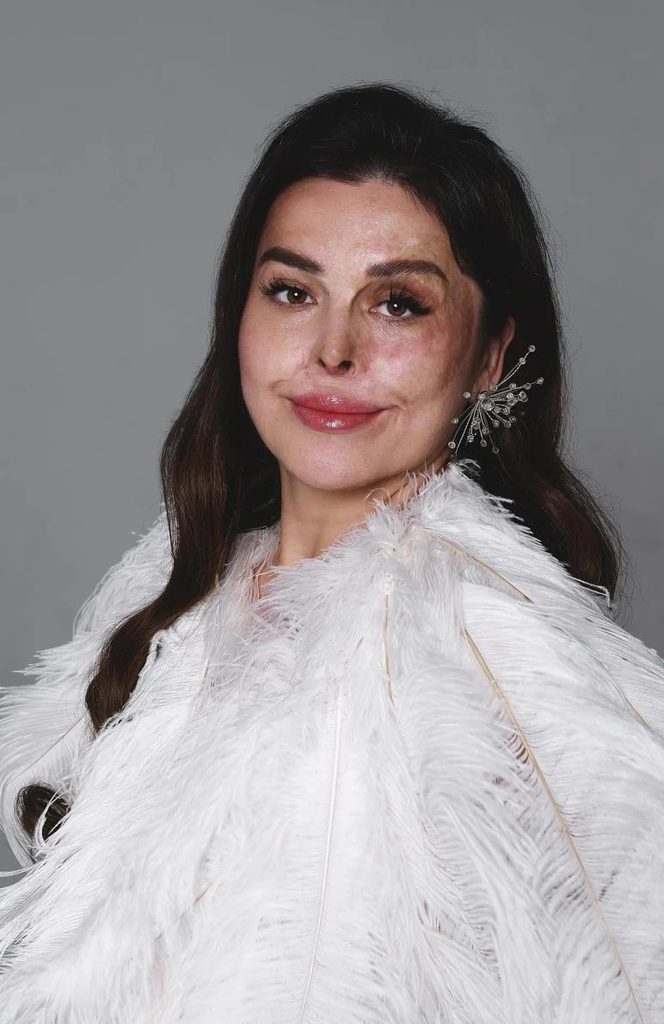 Jamila Ismailova — story of self-acceptance